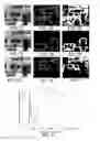 Fig. 07 - Active confocal imaging systems and methods for visual prostheses