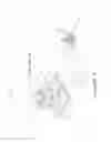 Fig. 03 - Angularly adjustable device for stabilizing impaled objects in the human body