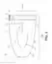 Fig. 04 - Protective disposable wrapper for tampons