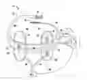 Fig. 01 - Device and method for simultaneous detection, monitoring and prevention of cerebral emboli