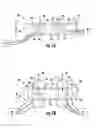 Fig. 10 - Device and method for simultaneous detection, monitoring and prevention of cerebral emboli