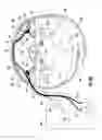 Fig. 11 - Device and method for simultaneous detection, monitoring and prevention of cerebral emboli