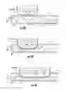 Fig. 14 - Device and method for simultaneous detection, monitoring and prevention of cerebral emboli