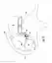 Fig. 16 - Device and method for simultaneous detection, monitoring and prevention of cerebral emboli