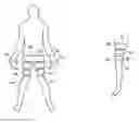 Fig. 01 - EXTERNAL COUNTERPULSATION APPARATUS
