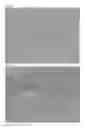 Fig. 03 - TOOTH SURFACE REPAIRING MATERIAL