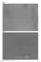 Fig. 04 - TOOTH SURFACE REPAIRING MATERIAL