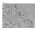 Fig. 08 - TOOTH SURFACE REPAIRING MATERIAL