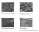 Fig. 04 - Composition for preventing or treating dental erosion