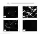 Fig. 03 - TOPICAL DAPSONE AND DAPSONE/ADAPALENE COMPOSITIONS AND METHODS FOR USE THEREOF
