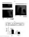 Fig. 08 - Method for treating, managing, inhibiting, or preventing obesity