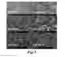 Fig. 04 - DRY POWDER FORMULATION OF AZOLE DERIVATIVE FOR INHALATION
