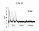 Fig. 20 - NITRITE AND NITRITE-METHEME THERAPY TO DETOXIFY STROMA-FREE HEMOGLOBIN BASED BLOOD SUBSTITUTES