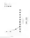 Fig. 53 - Genetic engineering of macrophages for immunotherapy