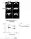 Fig. 08 - Method for treating an inflammatory brain disease comprising administering a stem cell-derived exosome