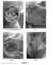Fig. 06 - COMPOSITION, SYSTEM AND METHOD FOR TREATING SKIN