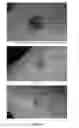 Fig. 07 - COMPOSITION, SYSTEM AND METHOD FOR TREATING SKIN