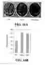 Fig. 26 - Composition for improving skin conditions comprising a fragment of human heat shock protein 90A as an active ingredient