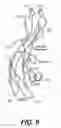 Fig. 12 - FOLLICLE STIMULATING HORMONE SUPERAGONISTS