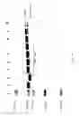 Fig. 43 - COMPOSITIONS AND METHODS FOR TREATING COLLAGEN-MEDIATED DISEASES