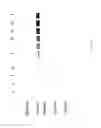 Fig. 60 - COMPOSITIONS AND METHODS FOR TREATING COLLAGEN-MEDIATED DISEASES