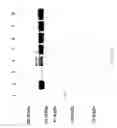 Fig. 70 - COMPOSITIONS AND METHODS FOR TREATING COLLAGEN-MEDIATED DISEASES