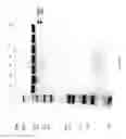 Fig. 79 - COMPOSITIONS AND METHODS FOR TREATING COLLAGEN-MEDIATED DISEASES