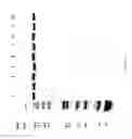 Fig. 82 - COMPOSITIONS AND METHODS FOR TREATING COLLAGEN-MEDIATED DISEASES