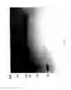 Fig. 85 - COMPOSITIONS AND METHODS FOR TREATING COLLAGEN-MEDIATED DISEASES