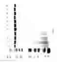Fig. 90 - COMPOSITIONS AND METHODS FOR TREATING COLLAGEN-MEDIATED DISEASES
