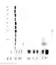 Fig. 91 - COMPOSITIONS AND METHODS FOR TREATING COLLAGEN-MEDIATED DISEASES