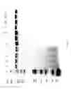 Fig. 92 - COMPOSITIONS AND METHODS FOR TREATING COLLAGEN-MEDIATED DISEASES