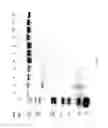 Fig. 93 - COMPOSITIONS AND METHODS FOR TREATING COLLAGEN-MEDIATED DISEASES