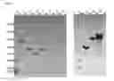 Fig. 02 - Polypeptides derived from and their use for vaccination and the generation of therapeutic antibodies
