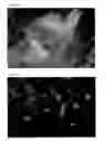 Fig. 06 - Drug conjugates for delivering compounds to senescent cells