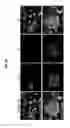 Fig. 05 - Endogenous neogenesis of beta cells