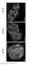 Fig. 20 - Endogenous neogenesis of beta cells