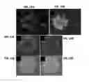 Fig. 26 - Endogenous neogenesis of beta cells