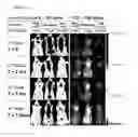 Fig. 23 - TCO conjugates and methods for delivery of therapeutic agents