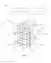 Fig. 07 - Fluid filtration apparatus
