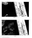 Fig. 07 - COLLAGEN BASED MATERIALS AND METHODS OF USING THEM