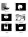 Fig. 02 - Compositions and methods for tissue repair with extracellular matrices