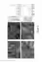 Fig. 07 - Methods for making a tissue engineered muscle repair (TEMR) construct in vitro for implantation in vivo