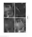 Fig. 08 - Methods for making a tissue engineered muscle repair (TEMR) construct in vitro for implantation in vivo