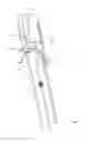 Fig. 02 - COLON CLEANING DEVICES AND METHODS