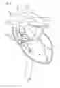 Fig. 02 - Intravascular blood pump