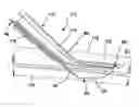 Fig. 01 - Systems and methods for creating arteriovenous (AV) fistulas