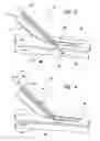Fig. 03 - Systems and methods for creating arteriovenous (AV) fistulas