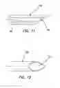 Fig. 07 - Systems and methods for creating arteriovenous (AV) fistulas