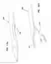Fig. 09 - Systems and methods for creating arteriovenous (AV) fistulas
